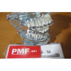 PMF - PROPULSOR MANDIBULAR FUNCIONAL PARA CLASSE II - TECNIDENT